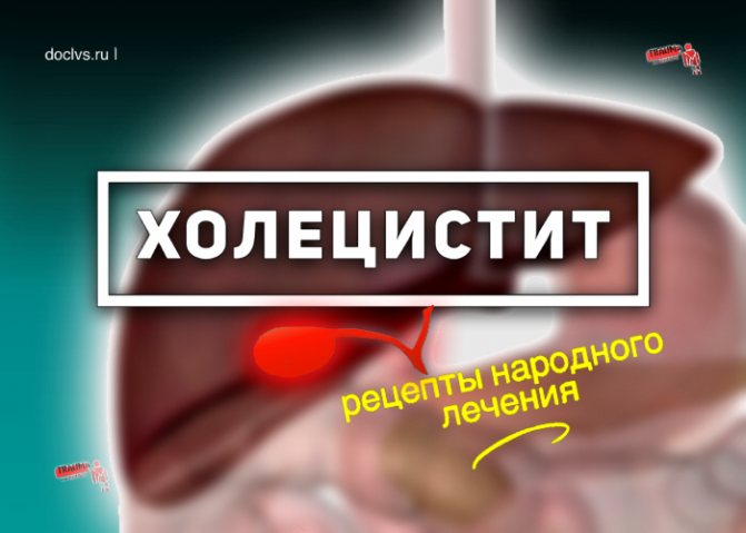 холецистит